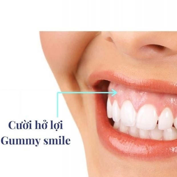 nhakhoatanhoanggia.vn