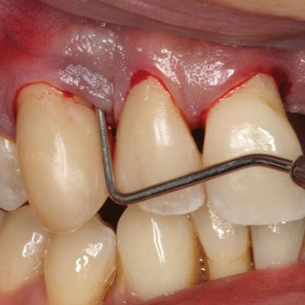 nhakhoatanhoanggia.vn