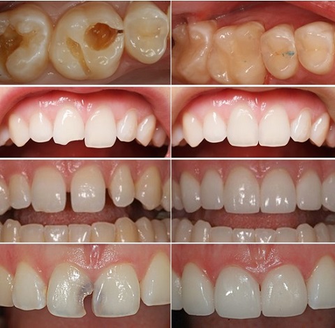 nhakhoatanhoanggia.vn